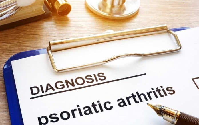 What Can Help With Psoriatic Arthritis? What Can Help With Psoriatic Arthritis?