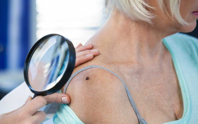 reduce-your-risk-of-melanoma-with-this-one-easy-step