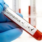 Coronavirus Update: Emergency Funding for Testing